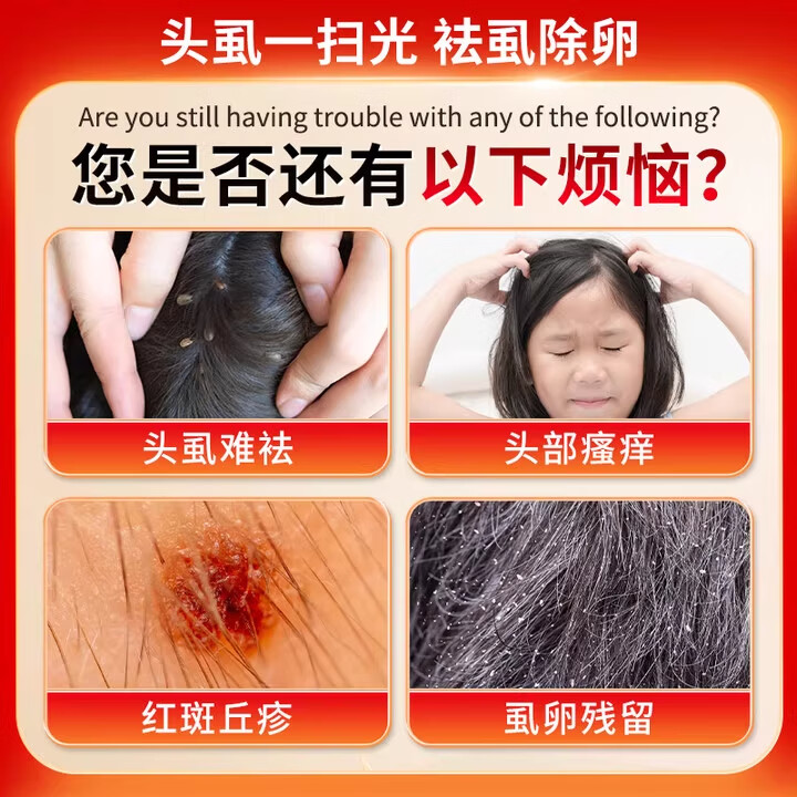 虱子药儿童头虱虱卵一扫光百部酊去头虱小女孩头发去除虱卵虱立净 1盒【60ml】一喷去虱