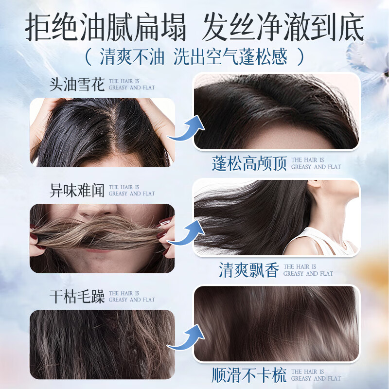 劳丽诗氨基酸洗发水植萃净爽头油头痒柔顺蓬松留香护发洗头膏露男女洗护 油腻扁塌-氨基酸洗发水（随机发） 300ml*2瓶