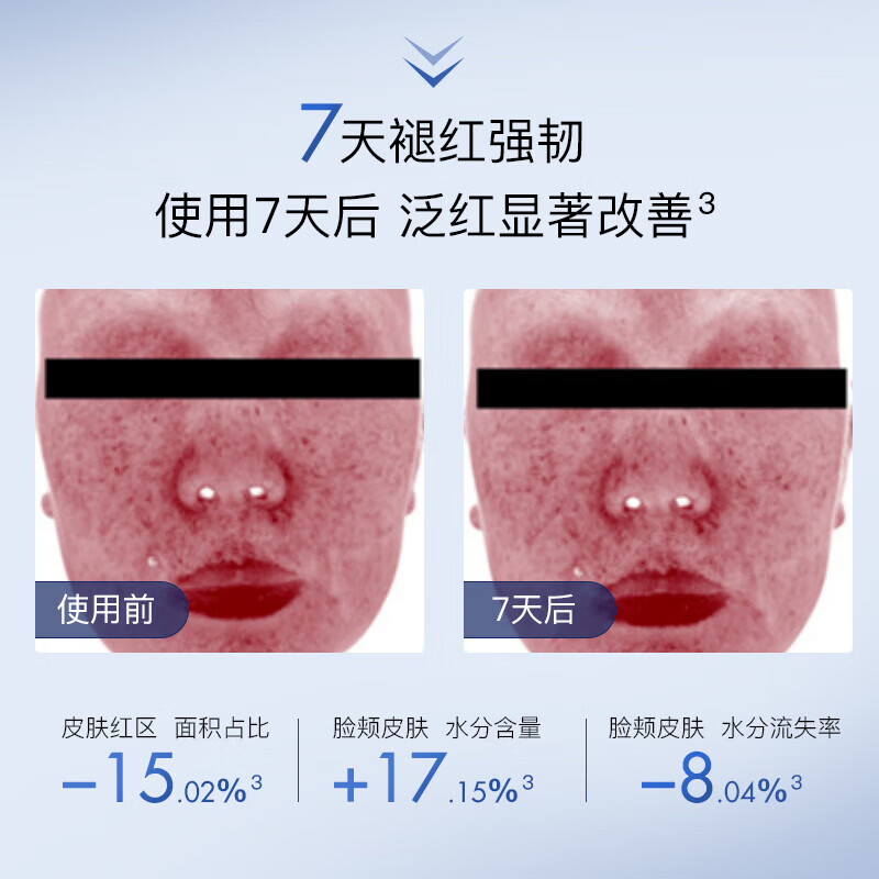 绽媄娅【活动款】钝感力精华焕能修护安肌精华液补水紧致舒缓 精华液40ml+蓝膜5片
