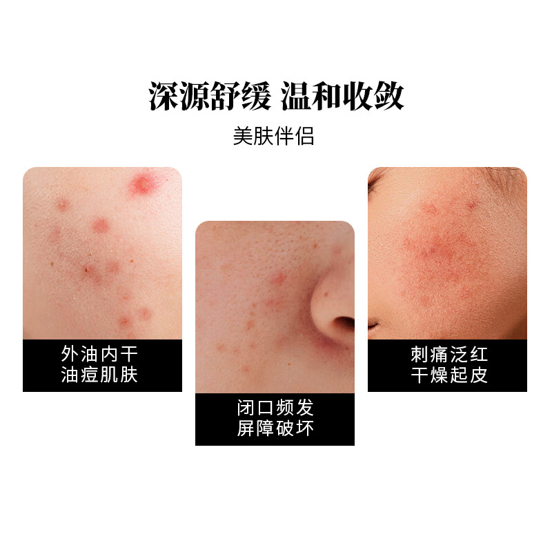 芳香世家现淳小花茉莉精华油+薰衣草纯露护肤套装 面部护肤淡纹亮肤 小花茉莉10ml+薰衣草纯露100ml