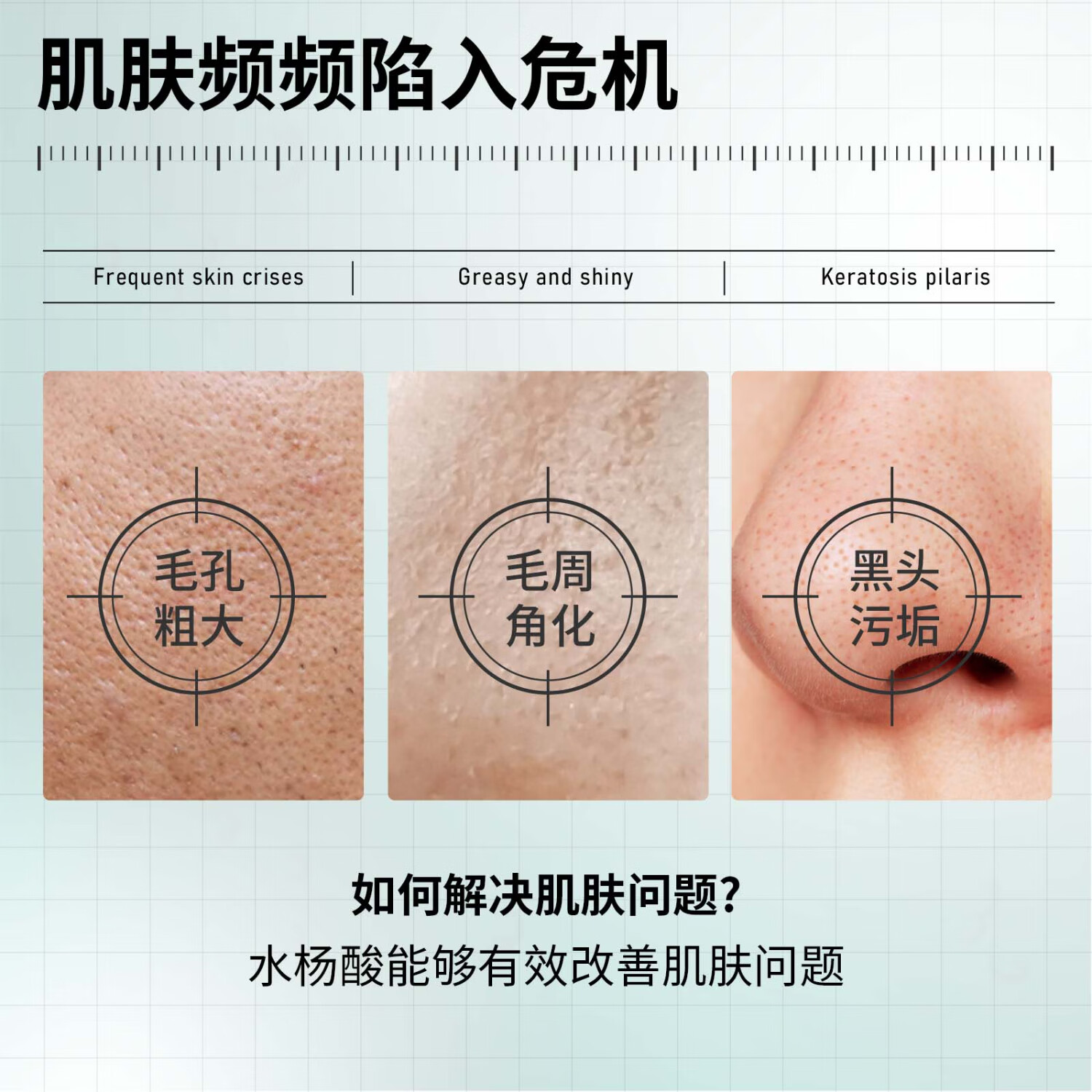 UOCC面膜细腻毛孔控油保湿水杨酸清洁肌肤痘痘闭口绿罐减黑头 两件装