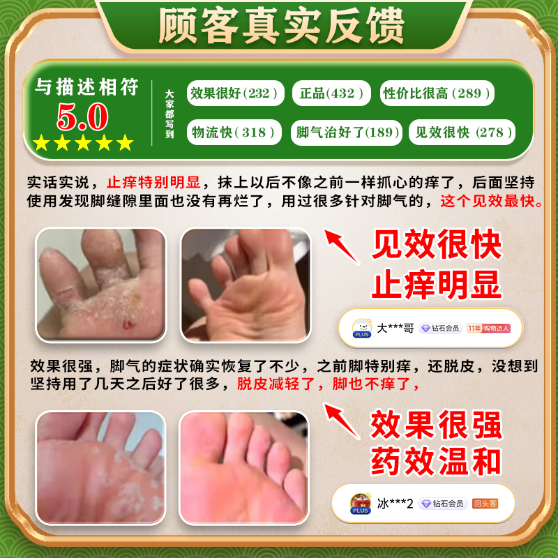 [恒久远]克霉唑乳膏 脚气药膏止痒脱皮烂脚丫真菌感染根药治起小水泡痒脱皮药去脚趾缝烂痒专用【视觉特效 10g 1盒装 【+1盒喷雾 先抹后喷效果更佳】