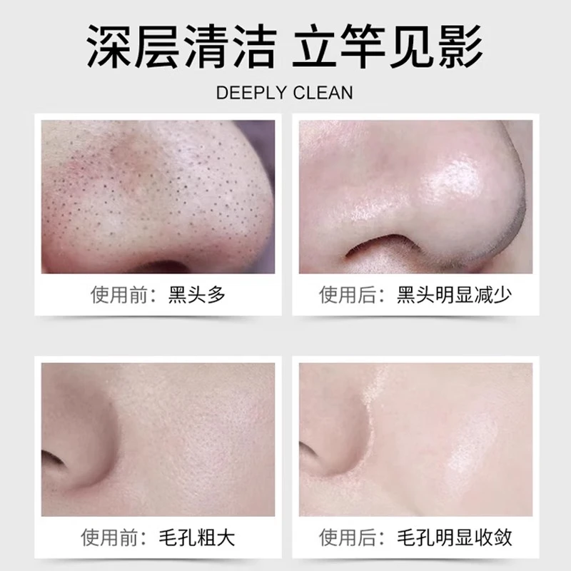 EEC清洁泥膜去黑头粉刺深层清洁收缩毛孔闭口脏东西涂抹式面膜女士 200g【实惠装】