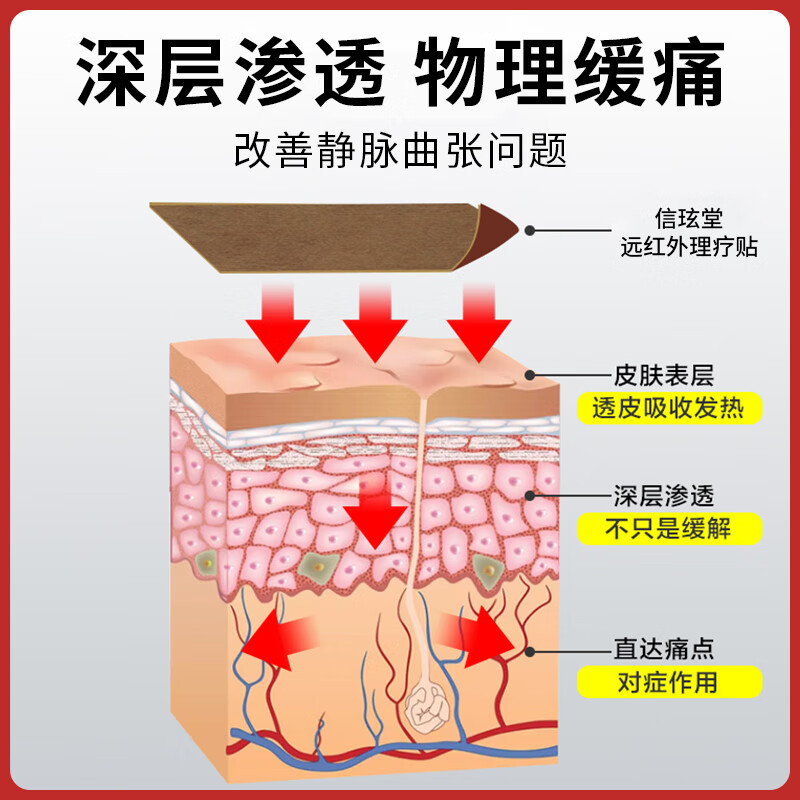 信玹堂静脉曲张专用远红外理疗贴蚯蚓腿红血丝小腿酸胀官方正品现货直发 5盒【特惠巩固装】95%用户选择