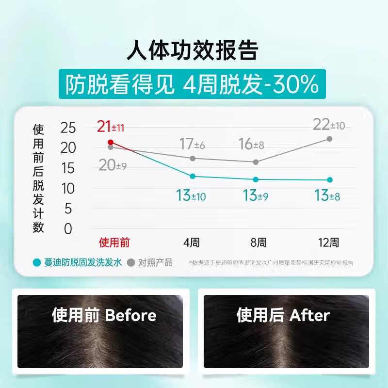 蔓迪防脱固发洗发水200g乌诺地尔养发育发米诺地尔近似物男女士洗头液 200g*2盒装【4周脱发-38%】