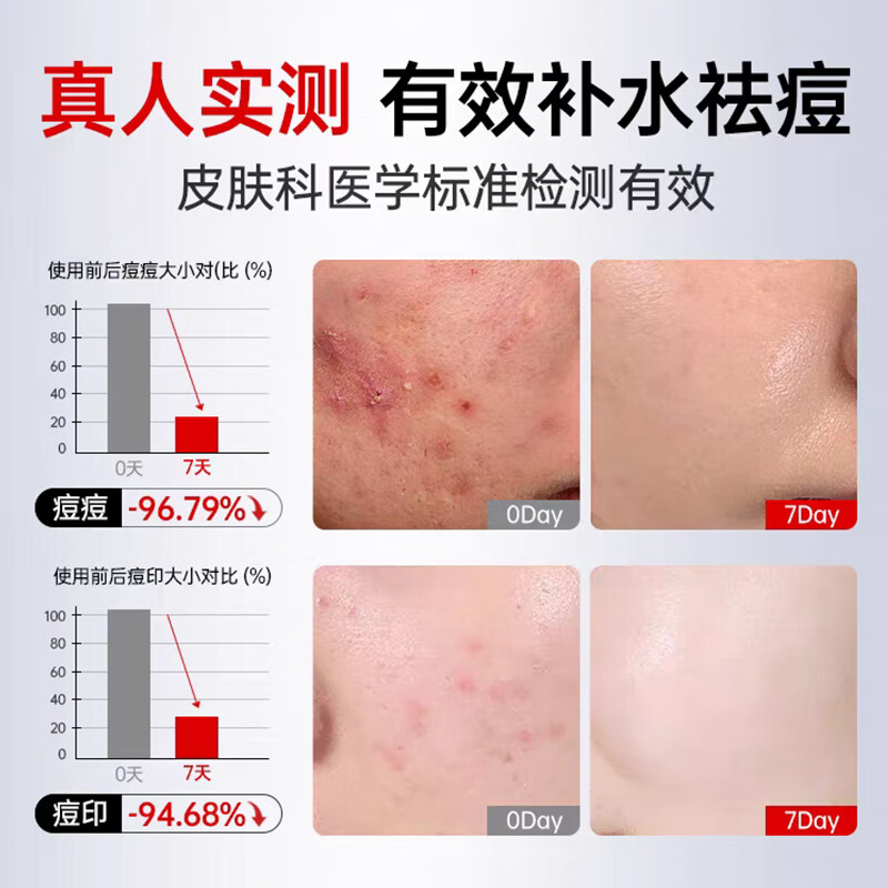 美人符水杨酸祛痘面膜补水保湿淡化痘印熬夜急救收缩毛孔舒缓男女士专用 10片 一盒装【控油舒缓补水】