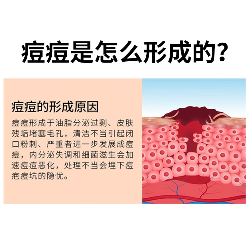 北京同仁堂痘痘贴消炎吸脓医用无菌修复痘印痘坑专用隐形人工皮水胶体敷料 八包装