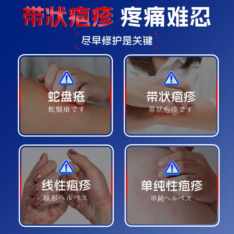 本桑制药带状疱疹后遗症神经痛膏断根蛇盘疮线性单纯性疱疹蛇胆疮专用膏 2盒周期套餐【只要1盒价】