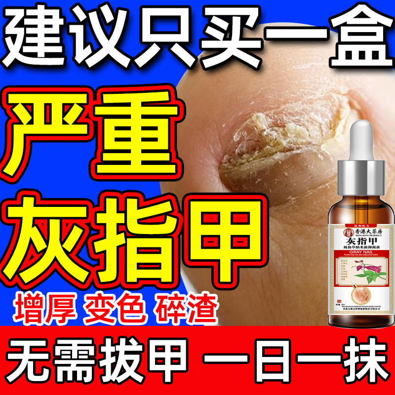 香港大药房灰指甲特傚效药第1名正品凤仙花指甲厚黄空真菌感染脱甲坏甲专用 【一个灰甲一盒就行】一盒装