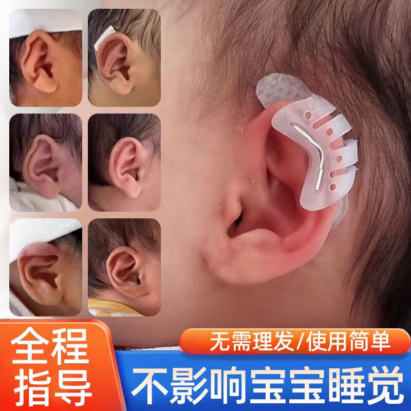 通用耳朵器婴儿硅胶耳朵器耳廓矫形新生儿畸形耳型垂耳纠正 耳撑[一对]+胶卷