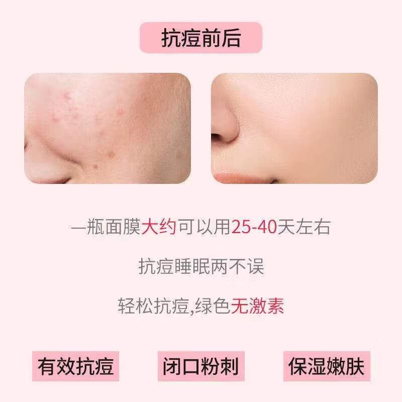 voodoo泰国蛇毒免洗睡眠面膜嫩白补水祛痘淡化痘印熬夜涂抹面膜 2瓶 30.5g