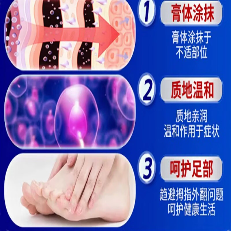 拇指外翻贴膏拇指外翻矫正器拇指疼痛变形重叠大脚骨突出拇指外翻 【重度拇指外翻】买五送四/9瓶