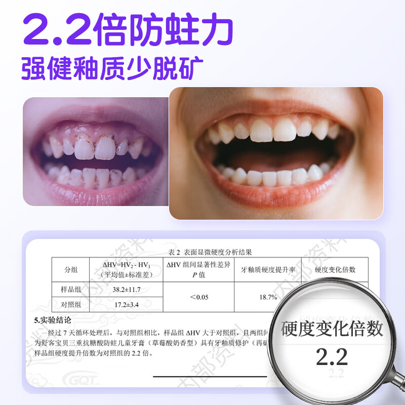 舒客宝贝儿童牙膏抗糖不辣口3-6-12岁防蛀含氟克服龋齿换牙期郭晶晶推荐 抗糖防蛀60g*2+护齿刷*2