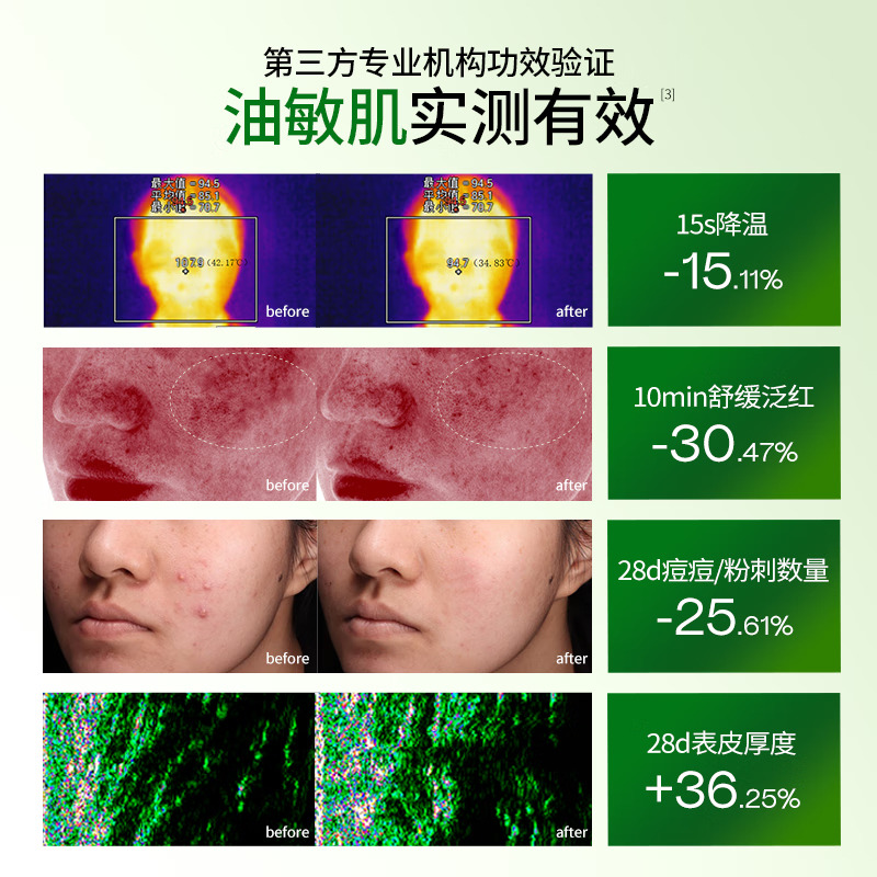 基理基底膜ECM修护霜干敏肌舒缓泛红屏障受损纤连蛋白面霜抗皱油敏霜 【油敏套装】洁面+水+清润霜50g