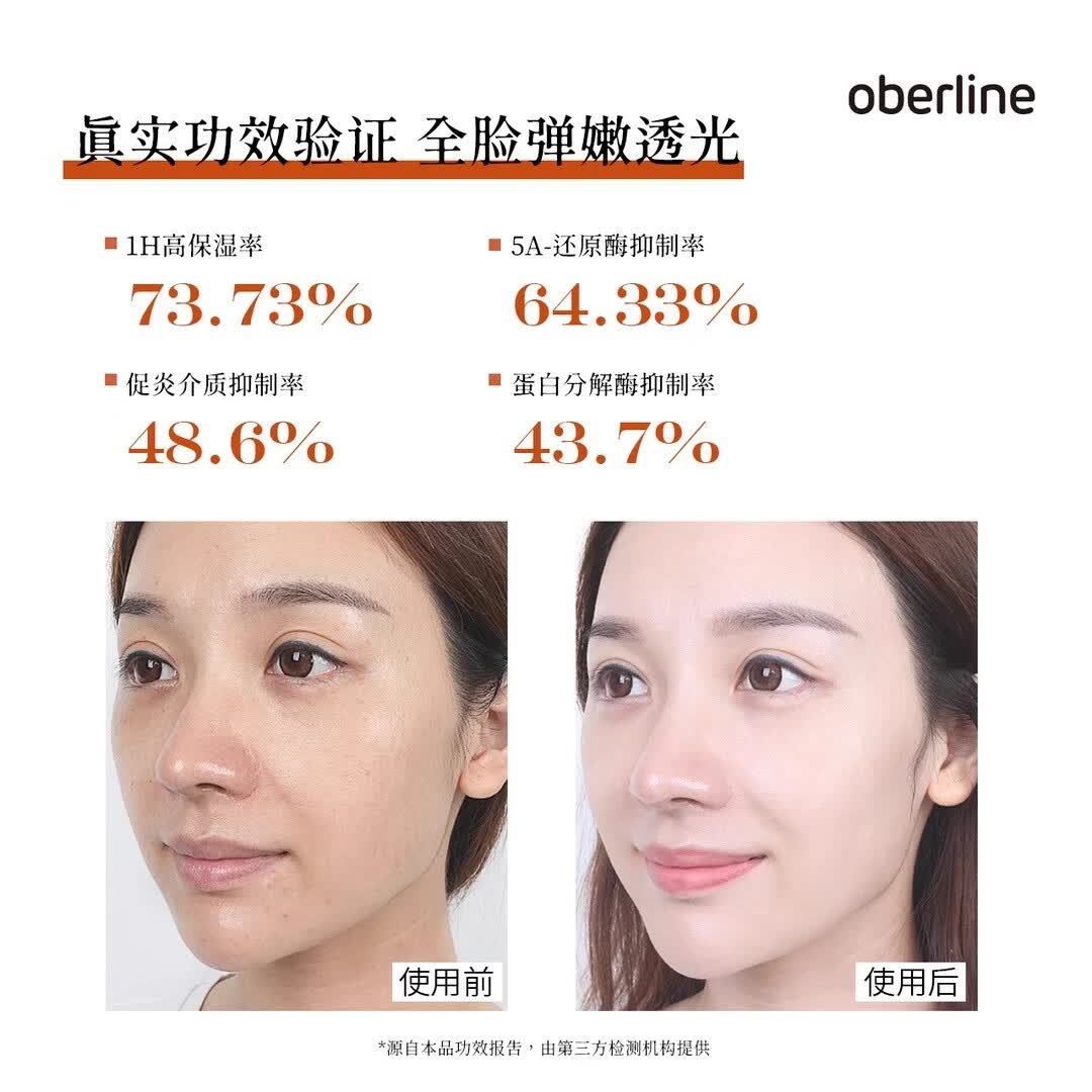 奥贝兰补水保湿水乳套装控油改善毛孔去黄提亮敏感肌护肤正品官方旗舰店 水110ml+乳80ml+乳液面膜3盒