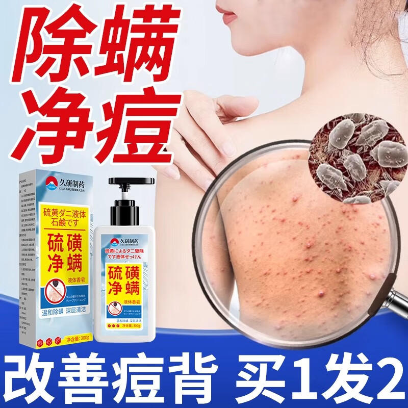 VKR硫磺除螨沐浴露皮肤瘙痒祛后背痘红点疙瘩止痒去螨虫液体香皂男女 2 瓶装【轻度瘙痒】 【日本】专攻除螨净痘
