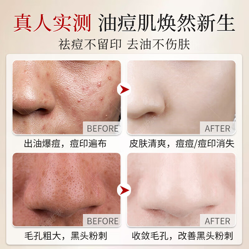 倾龄胖東來硫磺洗面奶控油除螨祛痘去黑头闭口粉刺去螨虫嫩白男女适用 【胖東來】硫磺洗面奶100g 买2送1 100g/支