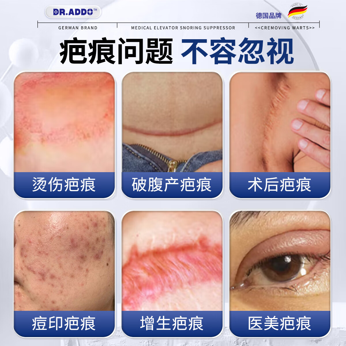 DR.ADDO医用疤痕贴剖腹产手术烧伤烫伤疤痕硅凝胶疤痕贴增生凸起去除疙瘩 1盒体验装【德系品质 药店同款】 剖腹产疤痕贴京棟自蓥官方旗舰店非丽森卡美皮肤疤痕贴