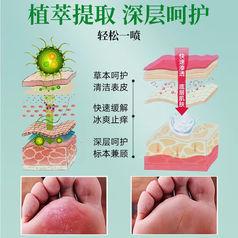 BIYAMAN云南本草脚气喷剂60ml 脚臭脚汗喷剂鞋袜除臭烂脚丫喷雾除脚酸臭 脚气喷剂60ml x3瓶
