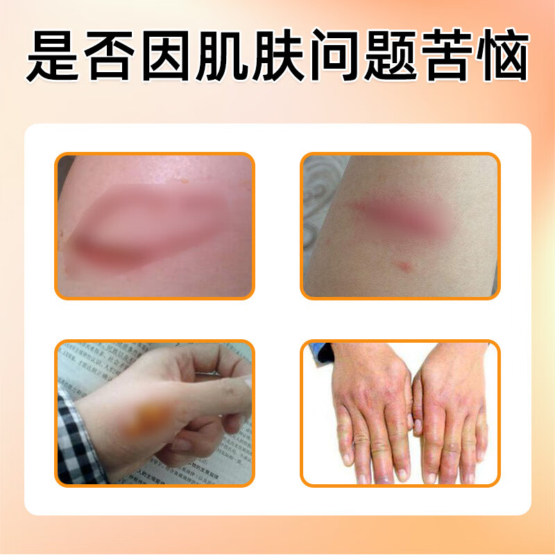 元荣沙棘籽油精油外用中华沙棘果籽油皮肤沙棘油搽擦剂同款