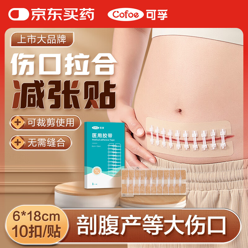 可孚减张贴剖腹产医用皮肤减张器免缝合拉链式创可贴6*18cm 10扣