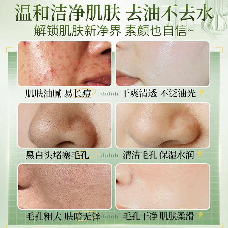 劳丽诗壬二酸洗面奶控油祛痘深层清洁黑头粉刺保湿补水洁面卸妆男女士 壬二酸控油祛痘洗面奶x 100g