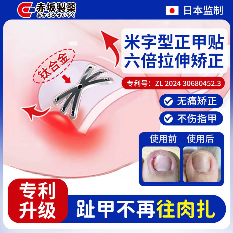 赤坂制藥甲溝嵌甲炎矯正器正甲貼指甲內(nèi)嵌糾正貼腳趾指甲往肉里長專用
