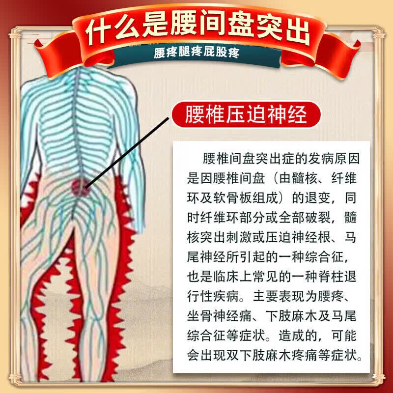 藤原石川制薬腰间盘突出膏药腰肌劳损压迫神经腰疼腰痛膏贴腰椎间盘突出进口药 特效膏 50个*1盒 【泰国透骨膏】 腰椎特效疗效专用最好的膏
