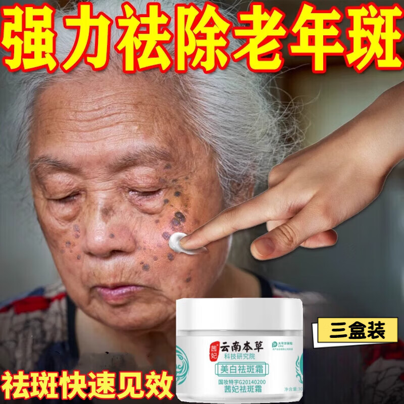 佰束点痣老年班去老人斑专用除老年黑班点斑霜黄褐斑强力祛除手部脸部 其它肤质 三盒超值装 胖线上商城超市营金榜第一正