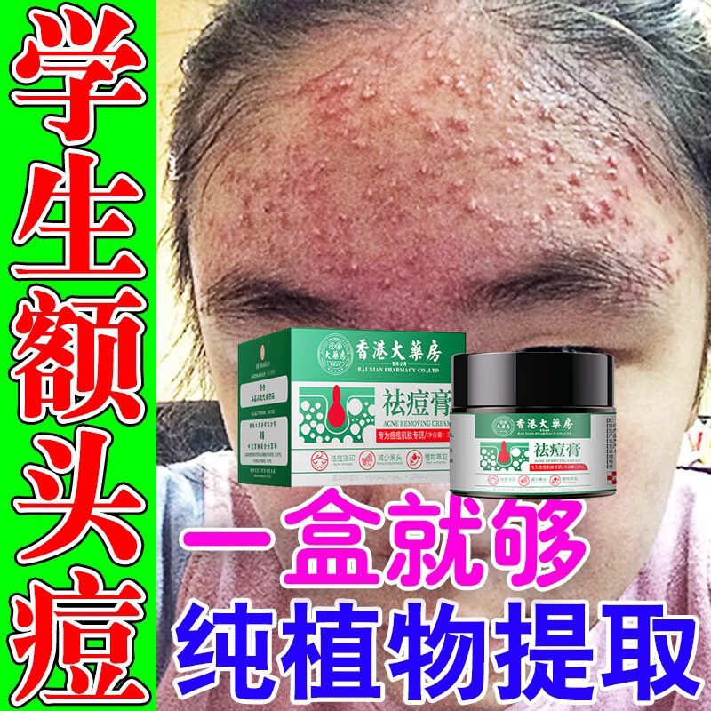 香港大药房祛痘膏和痘印坑修复痘痘和痘印青春痘消炎痤疮粉刺专用学生青少年 10瓶【买5送5】闭口粉刺