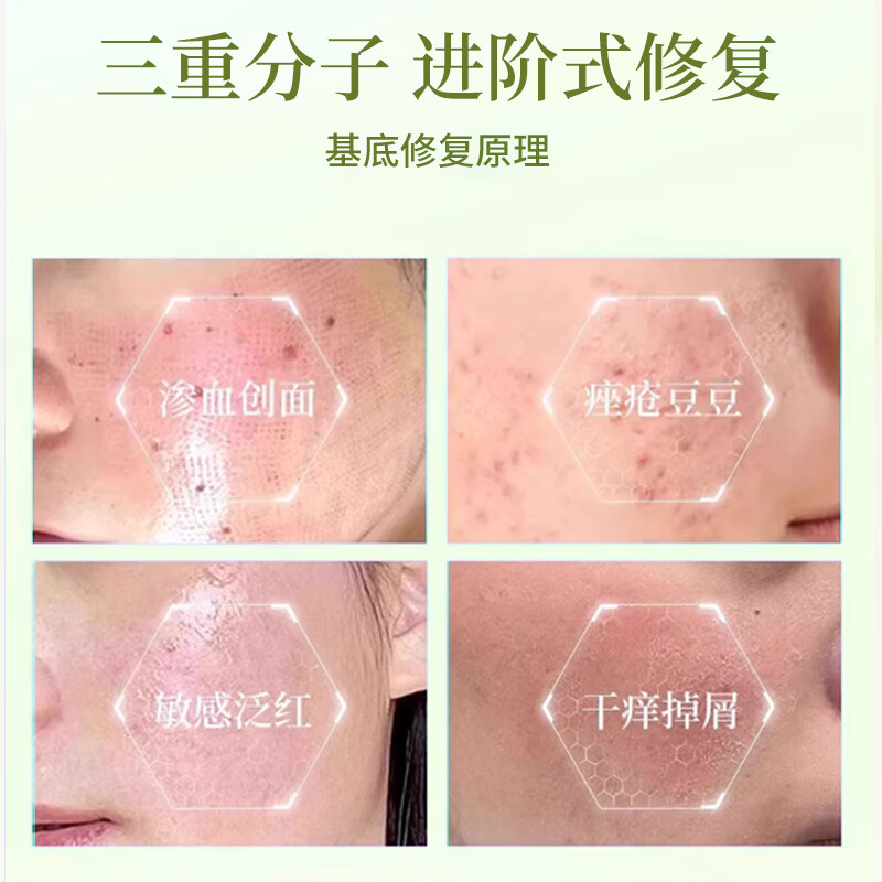 根拓小美医用重组胶原蛋白修护贴无香精无酒精保湿舒缓修复受损屏障