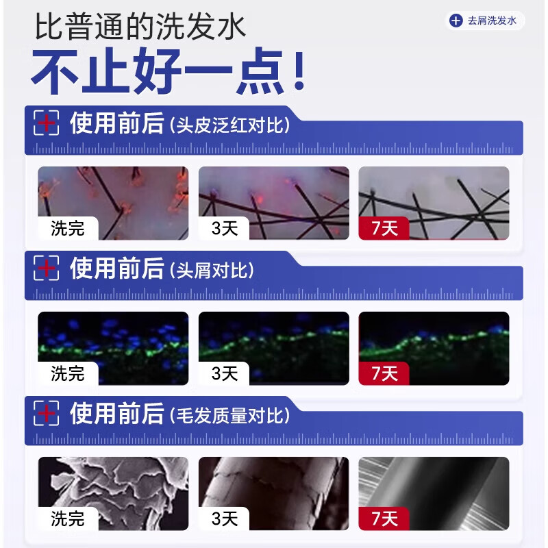 葛幸药房二硫化硒洗发水去屑止痒滋养头皮控油蓬松毛囊清洁头屑止痒 二硫化硒洗发水*1【去屑止痒】
