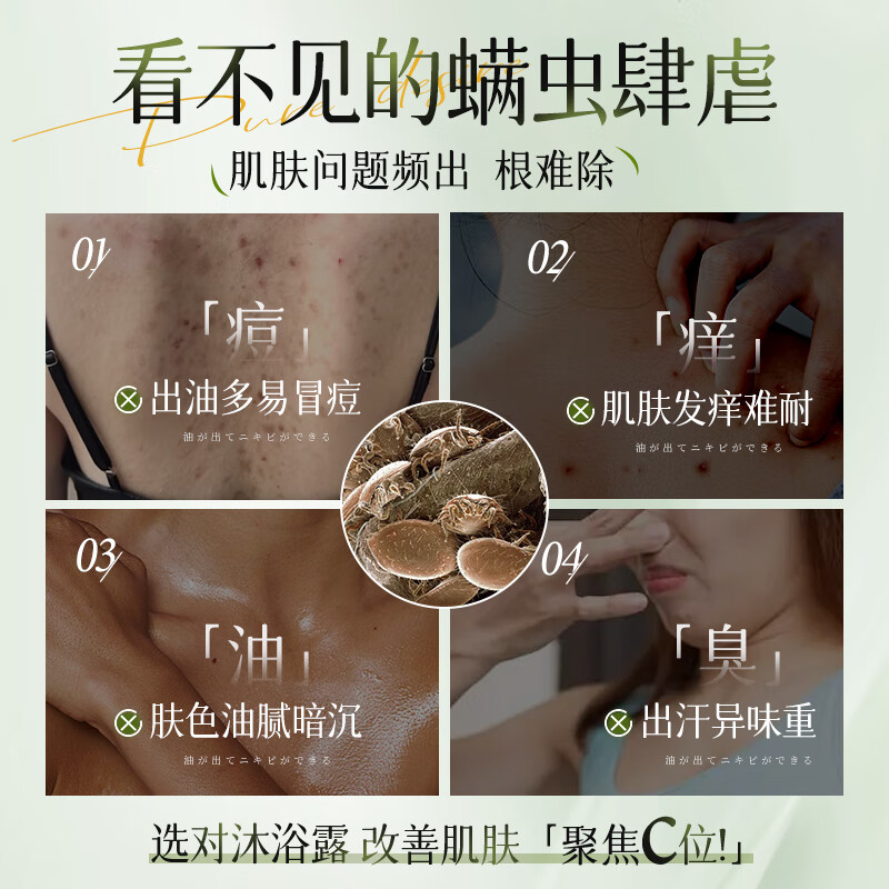 溥畔莜莜西子除螨沐浴露止痒祛痘控油去螨虫后背痘痘保湿液体香皂青少 [金标认证]儿童洗发沐浴二合一