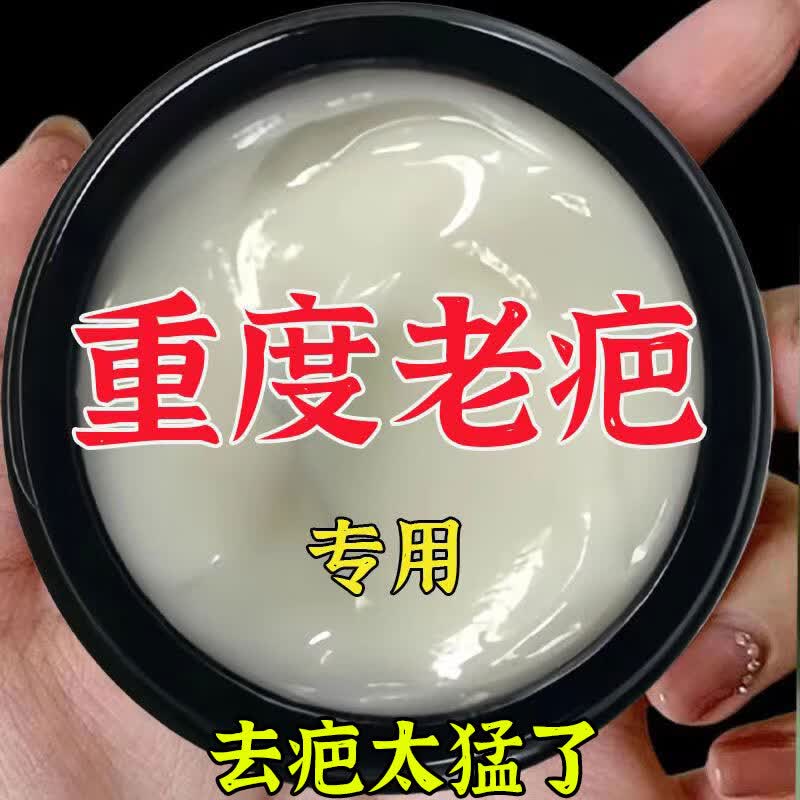 【香港中西薬邺】正品无痕修复淡化色素净肤膏烧伤凹凸祛痘坑痘印 买3送2【祛20年中度面积疤痕】