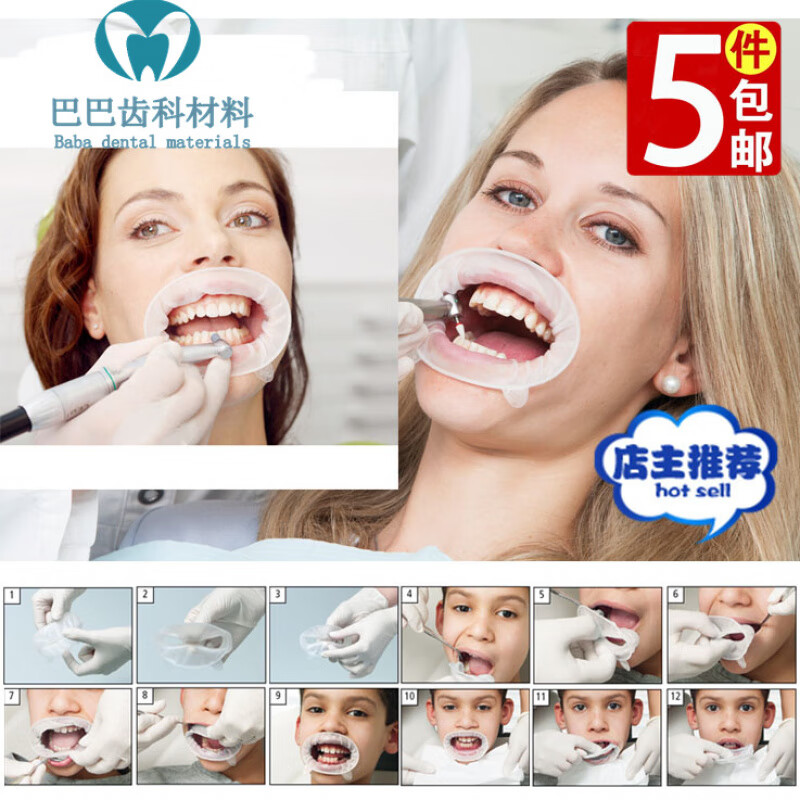 牙科义获嘉橡皮障开口器 张口器 儿童牙齿涂氟洁牙种牙用柔韧性好