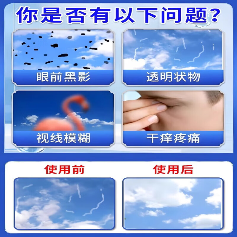 朵彤飞视宁滴眼液叶黄素日本进口眼前黑影飘动浑浊模糊飞蚊症眼药水
 三盒装买2送1【疗程装】