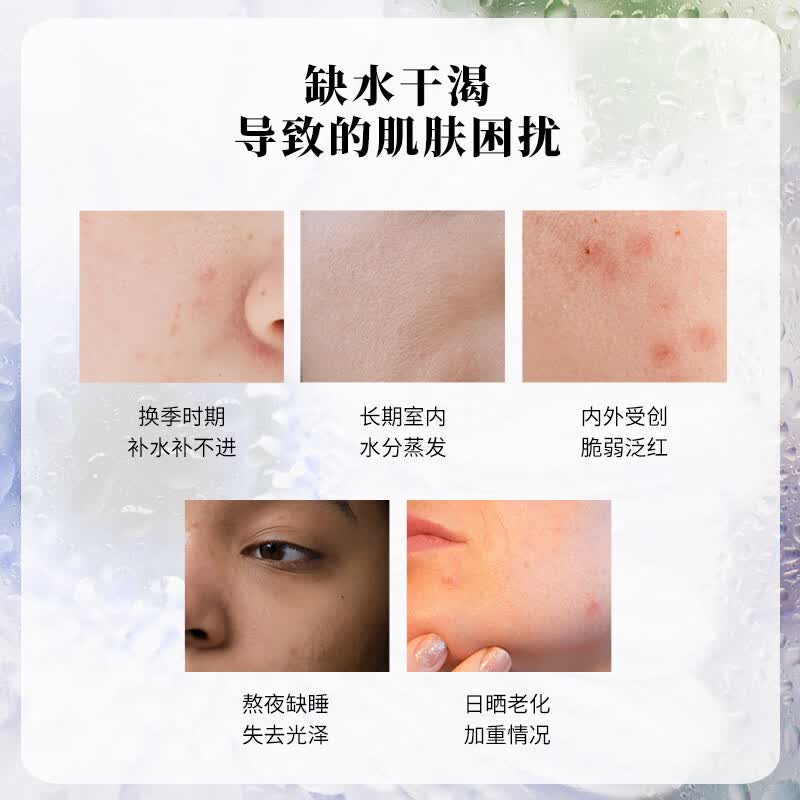芳香世家面部护肤精华油 润养熟龄肌脆弱肌熬夜肌复方精油新年礼物 【焕亮熟龄肌】保加利亚玫瑰凝时透靓精油10ml