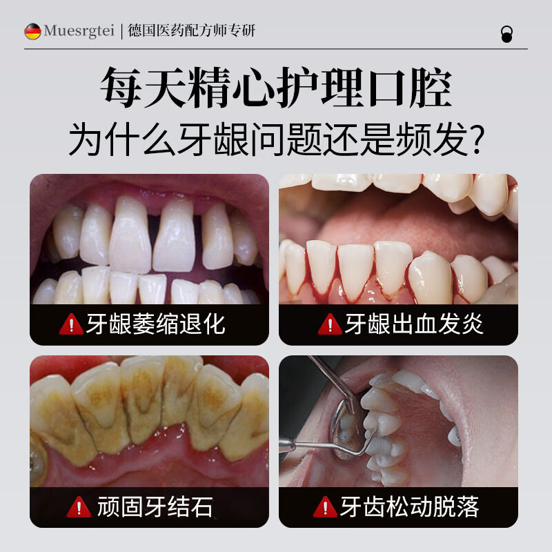 MUESRGTEI医用牙膏口臭去黄去牙渍去烟渍牙垢结石松动出血护龈十大知名品牌