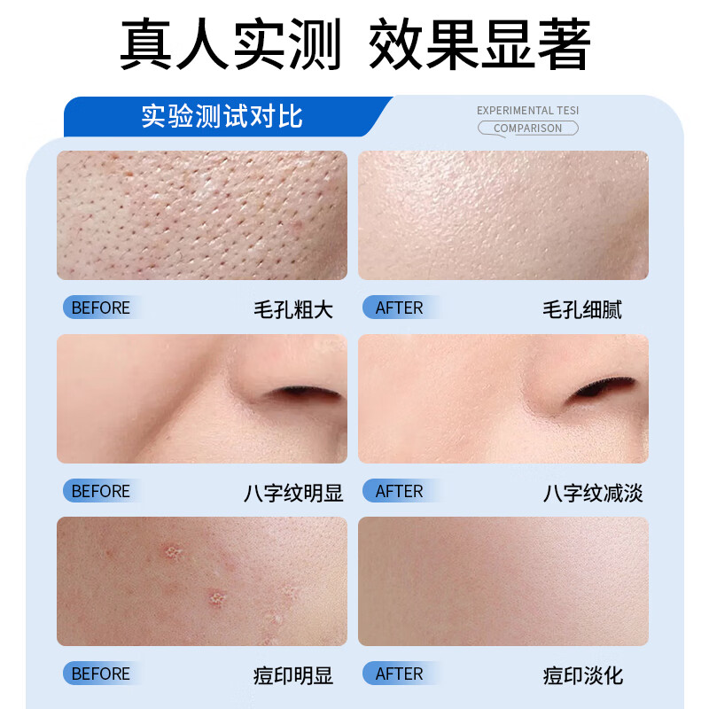 YXZZ护理膜YUOO胶原蛋白修护UO方蓝管细致毛孔收缩淡化痘印纹路 【周期装】3支装
