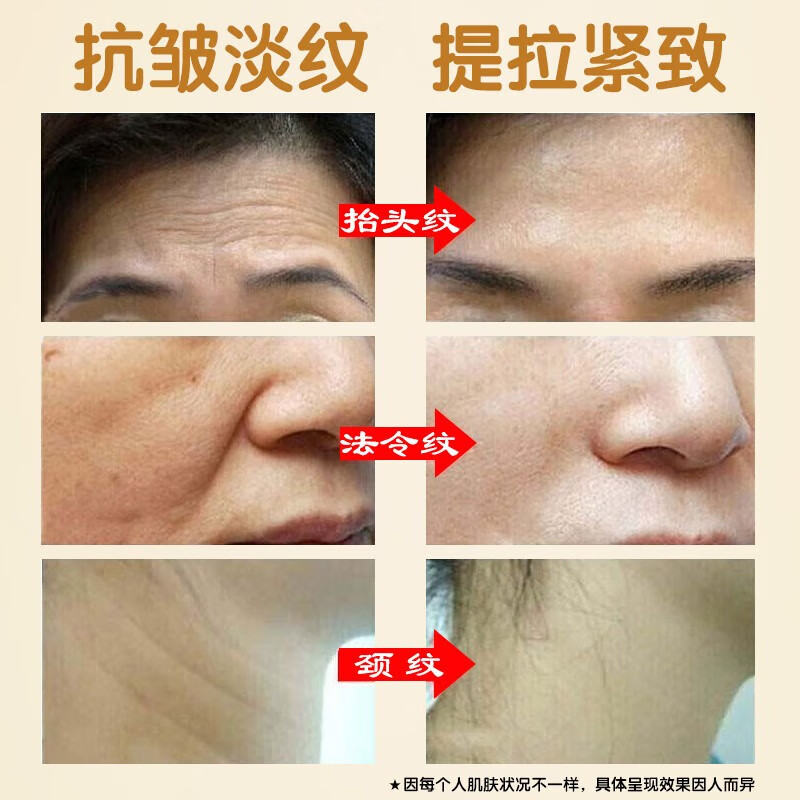 南京同仁堂抗皱面霜男女士护肤品 补水保湿提拉紧致淡化细纹抗皱嫩肤霜  百幽草 1瓶装【补水保湿】