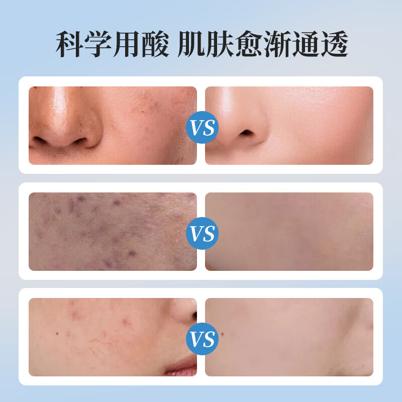 施颜适施颜适水杨酸棉片清爽控油收缩毛孔净颜刷闭口酸祛痘粉刺美国进口 【1%浓度】进阶型55片*1盒