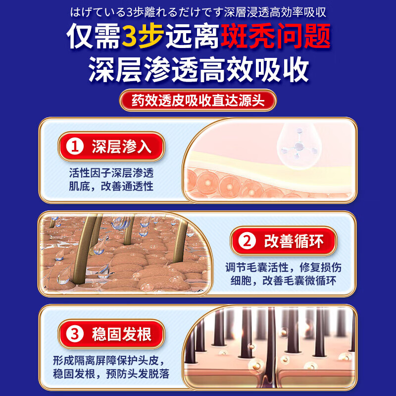 岩井昃弘日本斑秃外用脱掉发严重鬼剃头专用快速生发液日本进口斑秃100%药 100%特效：三盒【升级进口配方】