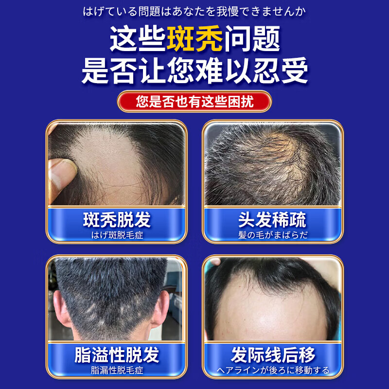 岩井昃弘日本斑秃外用脱掉发严重鬼剃头专用快速生发液日本进口斑秃100%药 100%特效：三盒【升级进口配方】