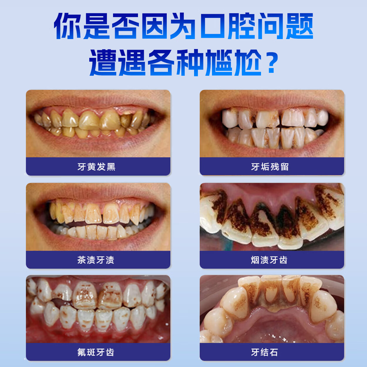 牙医生(Yaeason)去渍美白牙膏专利去渍牙齿牙黄含氟防蛀齿成人祛除牙垢烟男女士用 【美白+去渍】 120g*1支 + 180g*1 官方旗舰正品