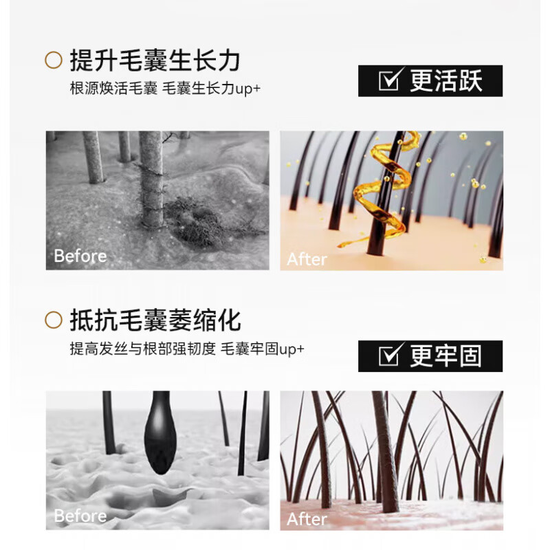 AutumnValley澳恬维生物素防脱复合包脱养发防际头线增长发密养发护育黄金养发 3盒周期装 激活毛囊 深层滋养【60%顾客选择】