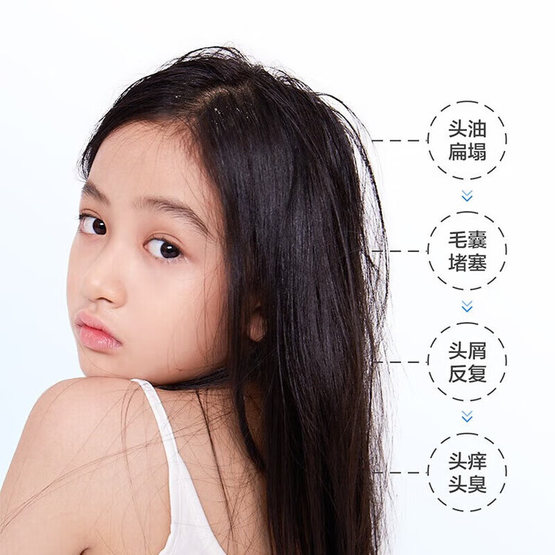 红色小象青少年去屑洗发水深层洁净控油学生女孩男大童洗发乳蓬松清爽止痒 【青少年专研】洗发水400g