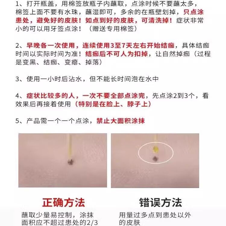 南京同仁堂疣瘊灵去除脖子小肉粒扁平疣体脱落药水平疣净疣立净尤净点肉疙瘩 1盒【Q疣】疣瘊一抹灵