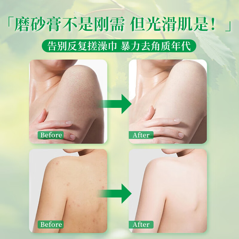 维蕾德(WELEDA)瑞士进口白桦木身体磨砂膏去角质死皮鸡皮关节黑嫩白全身深层清洁男女士 有机白桦磨砂膏150ml