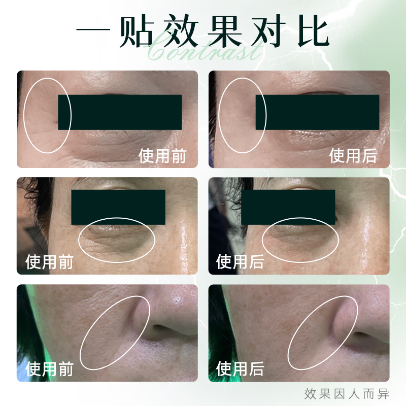 荷妮【钟丽缇同款】电子面膜仪礼盒 抗皱紧致提拉神器 面部普拉提