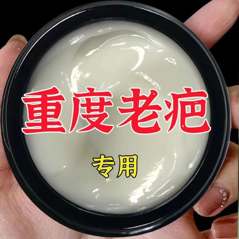 【香港中西薬邺】正品无痕修复淡化色素净肤膏烧伤凹凸祛痘坑痘印 买3送2【祛20年中度面积疤痕】 京东折扣/优惠券